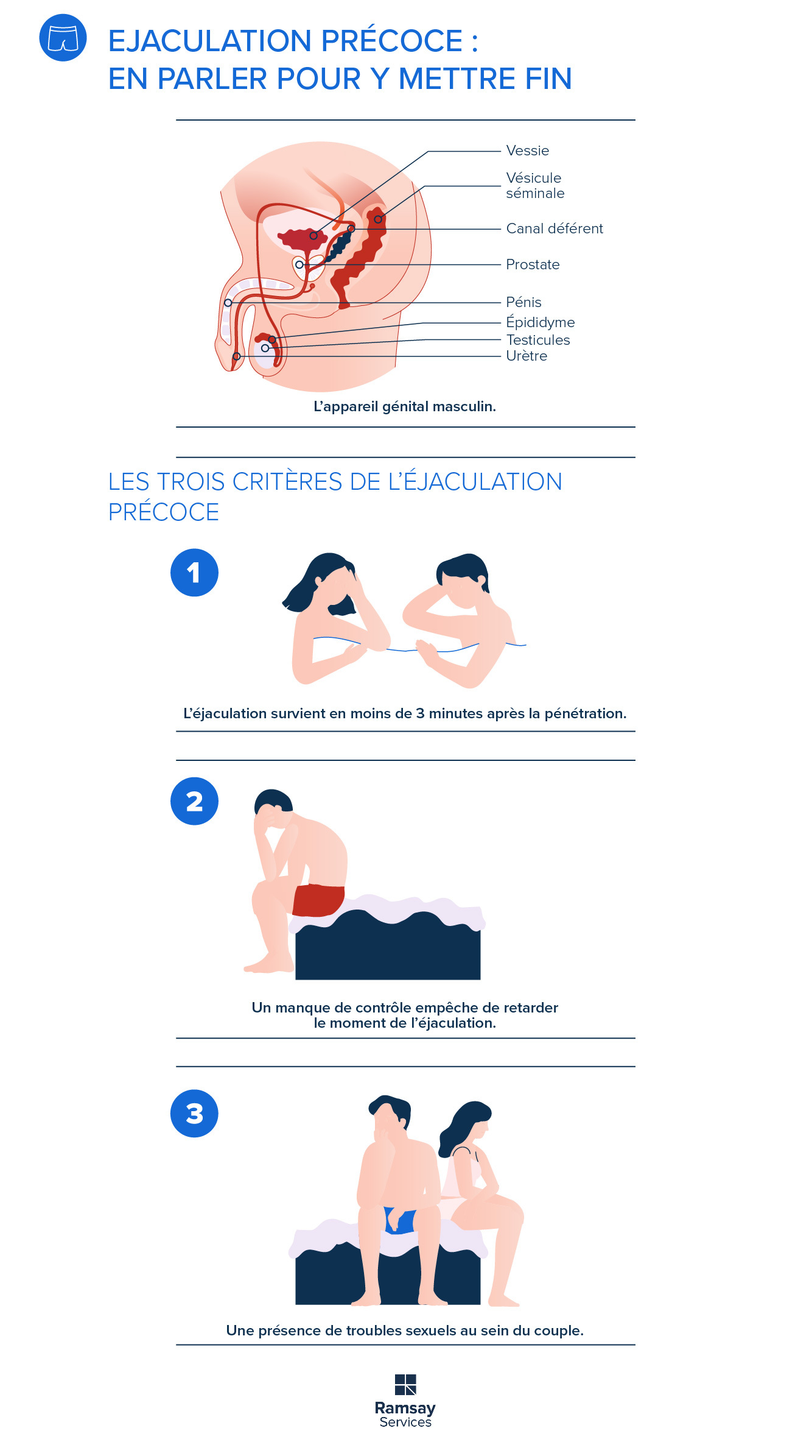 Ejaculation précoce : en parler pour y mettre fin