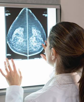 Dépistage du cancer du sein : pourquoi et quand le faire ?