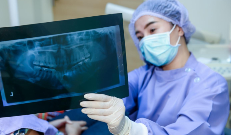 Mâchoire : tout savoir sur la chirurgie orthognatique
