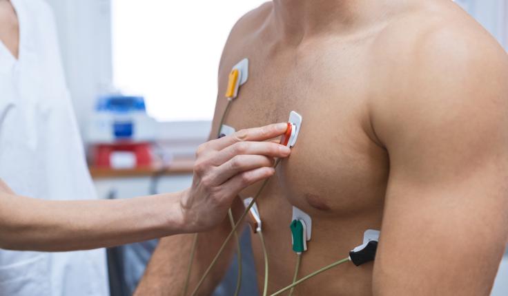 ECG