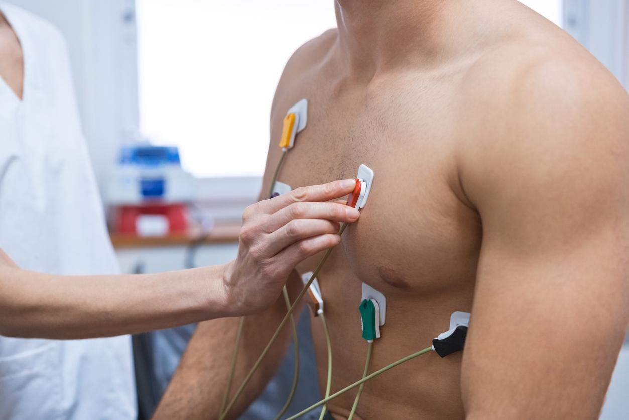ECG