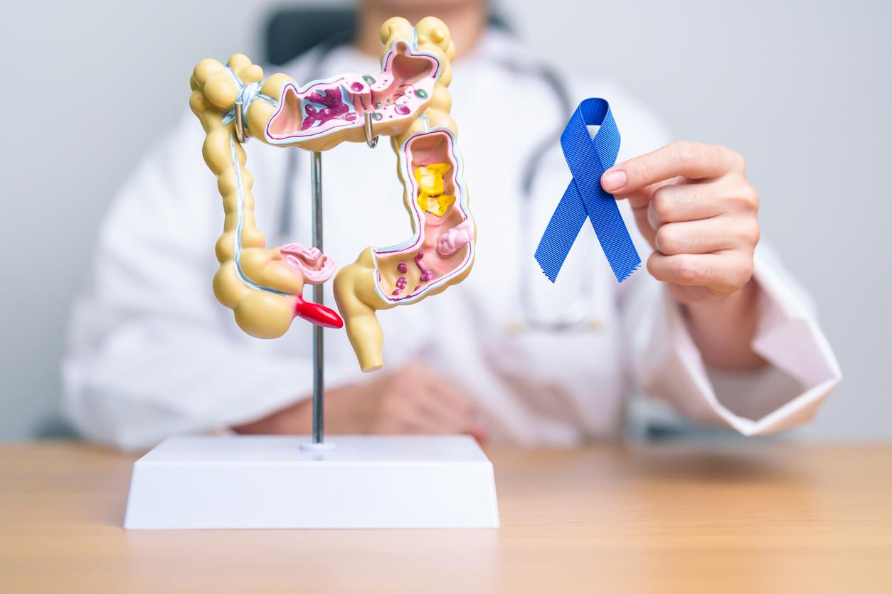cancer colorectal